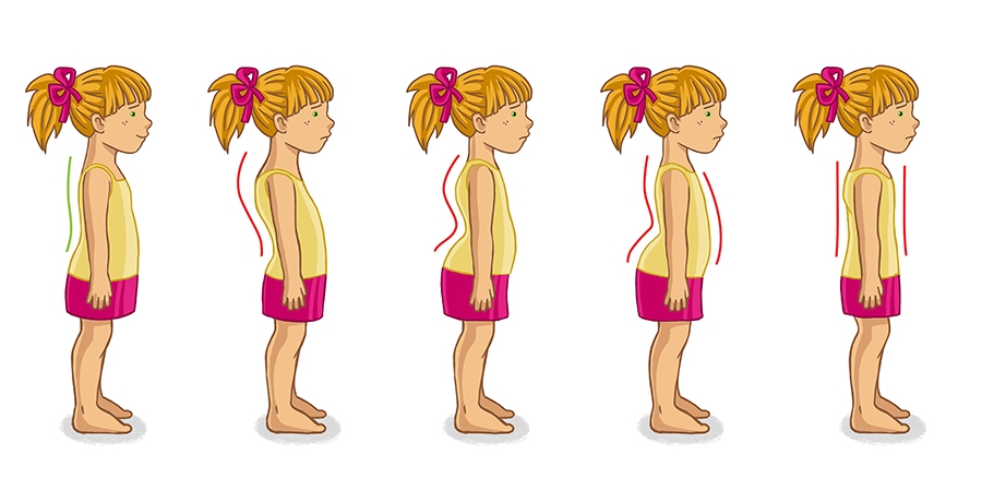 упражнения для формирования осанки